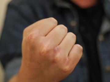 На Волині судили чоловіка, який побив водія хлібзаводу за відмову його підвезти