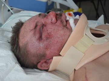 Судитимуть двох волинян, які побили і залишили помирати афганця