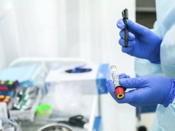 На Волині за добу 12 людей померли від коронавірусу