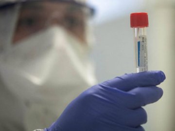 Повідомили, скільки заражених COVID-19 виявили в Україні за останню добу