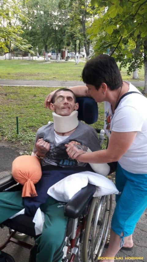 Життя загнало у глухий кут: мама просить допомогти з лікуванням сина, який постраждав у аварії