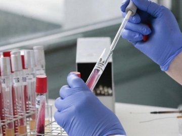 На Волині за останню добу виявили 4 випадки коронавірусу