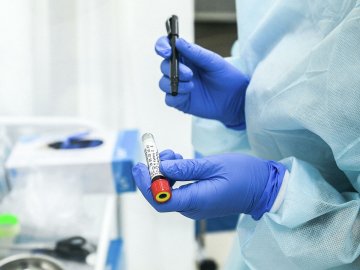 Ранок 15 жовтня: в Україні – 5 062 нових випадки коронавірусу, на Волині – 180