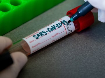 В Україні – новий рекорд за кількістю одужалих від коронавірусу за добу