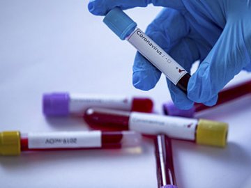 Ранок 3 жовтня: в Україні – новий коронавірусний антирекорд, на Волині – 130 випадків