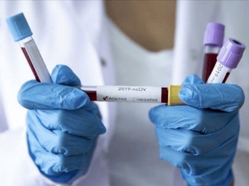 Повідомили, скільки заражених COVID-19 виявили на Волині за останню добу