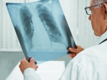 В Україні зареєстрували інноваційний препарат проти туберкульозу