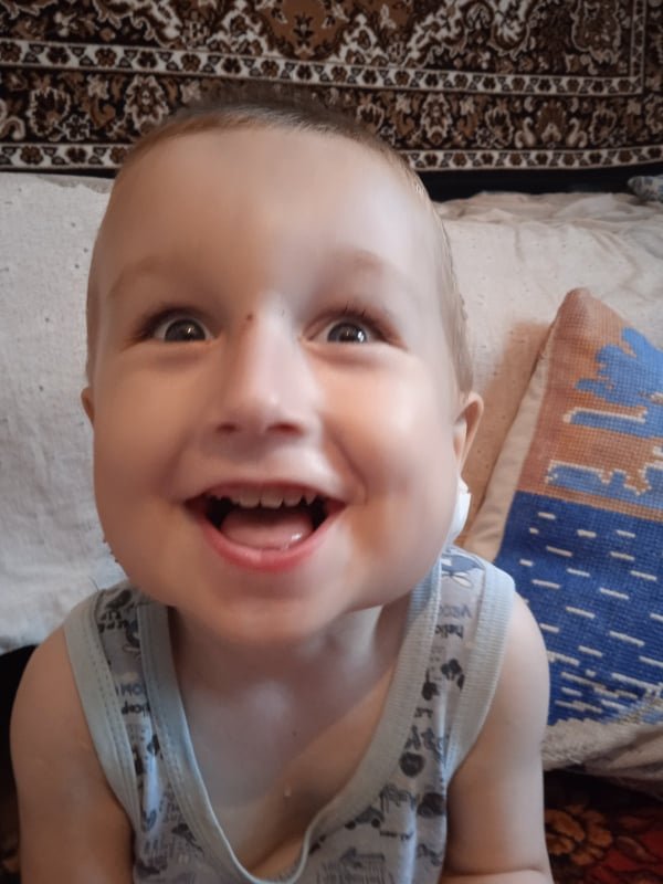 Потрібно більше 10 тисяч доларів: хлопчику з Волині збирають кошти на другу операцію