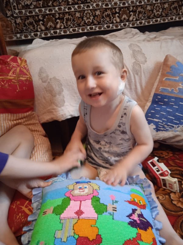 Потрібно більше 10 тисяч доларів: хлопчику з Волині збирають кошти на другу операцію