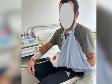 Луцькі хірурги пришили руку 37-річному чоловіку