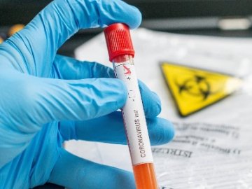 Дві смерті та 41 новий випадок: ситуація з коронавірусом на Волині станом на ранок 22 липня