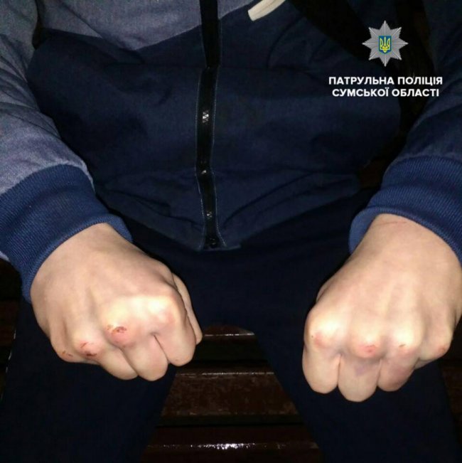 У Сумах 16-річний підліток побив і зґвалтував дівчину