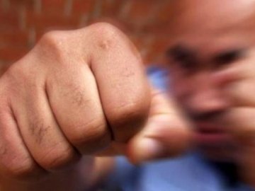 Через «п'яну» суперечку волинянин залишився без зубів