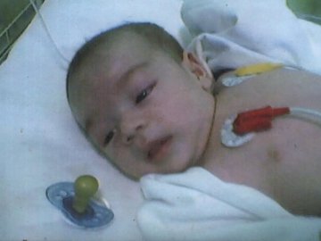 Збирають гроші  на операцію 7-місячному хлопчику з Волині