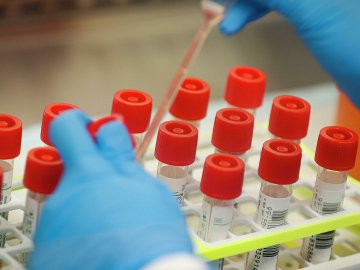 Де на Волині за останню добу виявили найбільше нових хворих на коронавірус 