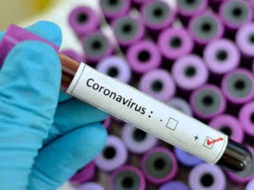 У Чехії – троє заражених на коронавірус