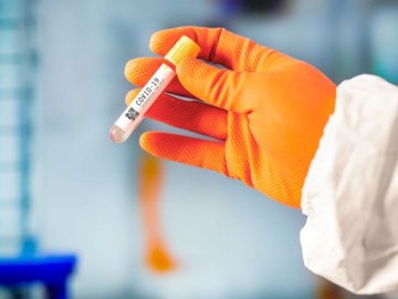 На Волині за минулу добу виявили 214 нових випадків Covid-19, 4 – летальні