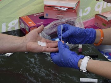 У Луцьку один день безкоштовно обстежуватимуть на гепатит