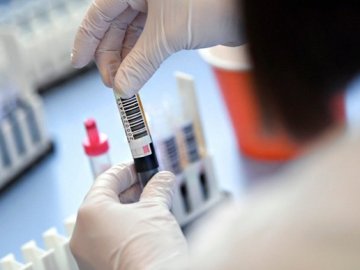 Коронавірус на Волині: повідомили ситуацію за останню добу
