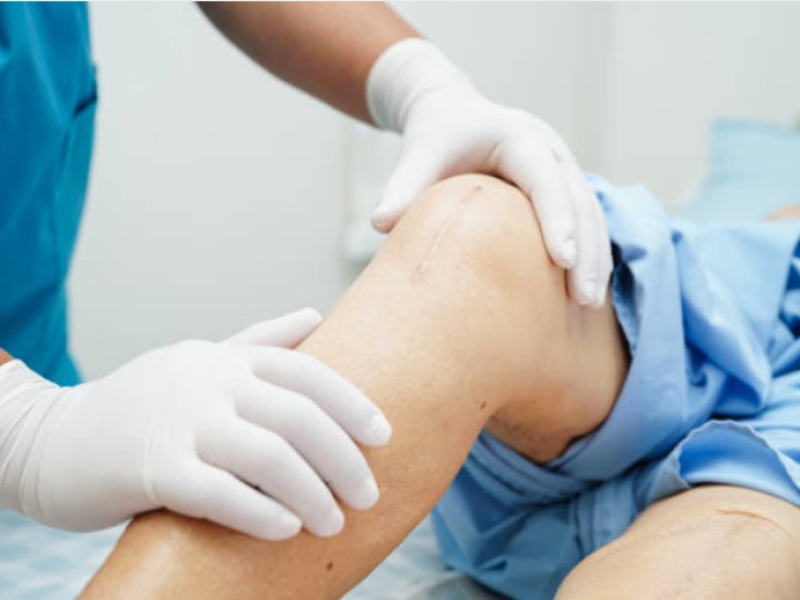 Який тип шунту краще: власний судинний чи штучний? Що обирають кардіохірурги у Львові і чому?