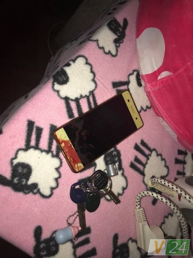 Хотів погуляти: лучанин зламав носа своїй дружині. ФОТО