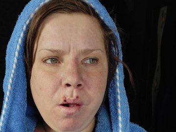 На Волині поліція розшукує безвісти зниклу 33-річну жінку. ФОТО