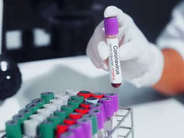 В Україні за добу – 1 592 випадки коронавірусу, з них на Волині – 48