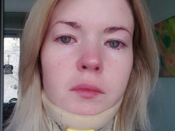 У Луцьку організовують автоквест, аби допомогти хворій дівчині