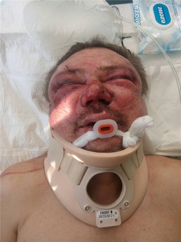 На Волині знайшли чоловіка у важкому стані, шукають родичів. ФОТО