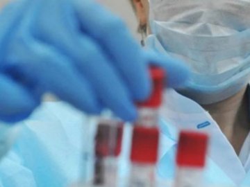 112 нових випадків і чотири смерті: ситуація з коронавірусом на Волині за минулу добу