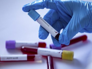 В Україні за добу виявили понад 9 тисяч хворих на коронавірус