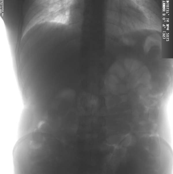 У Луцьку знищили два кілограми наркотиків. ФОТО