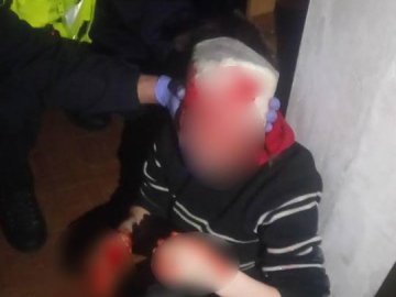Волинські патрульні врятували жінку з проламаною головою. ФОТО. ВІДЕО