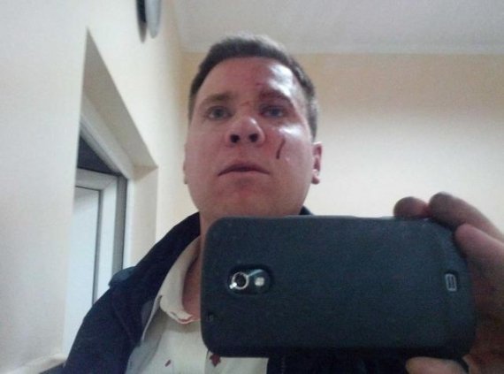 У Сімферополі побили американця