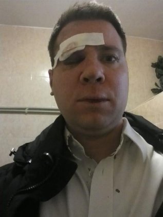 У Сімферополі побили американця