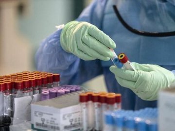 Коронавірус на Волині: повідомили ситуацію за минулу добу