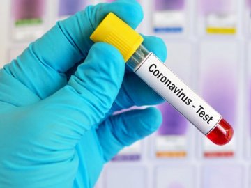 У Любліні вперше виявили інфікування коронавірусом: хворий – у важкому стані
