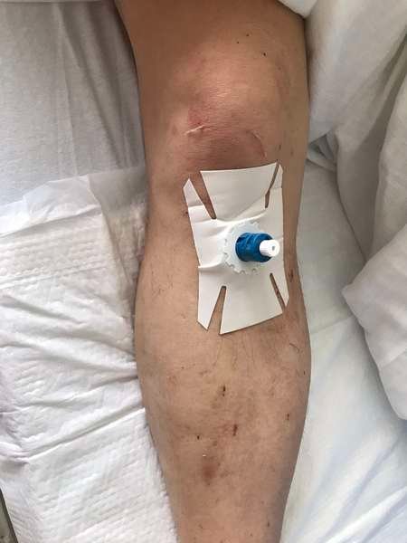 На Волині медики «швидкої» врятували чоловіка, у якого зупинилося серце