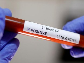 У 8 людей, які перетинали кордон через Волинь, експрес-тест показав позитивний результат на COVID-19 