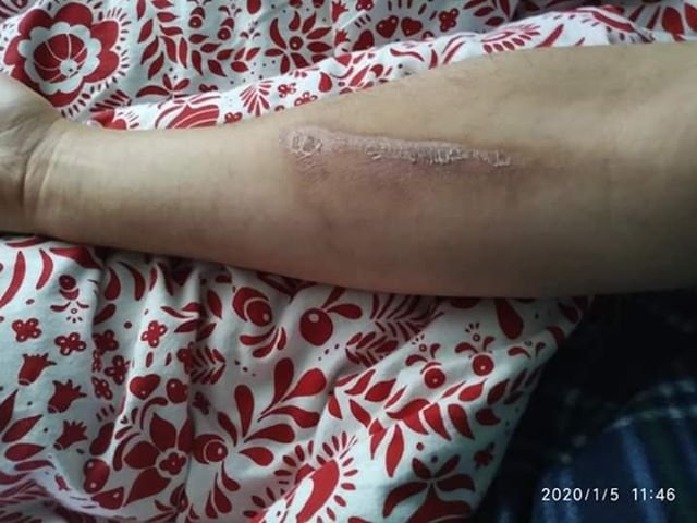 Онкохворий волинянин, у якого пухлина врослася у сусідні органи, потребує допомоги 