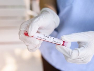 150 хворих та 1 смерть: де на Волині виявили найбільше нових випадків Covid-19 за добу