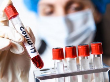 Новий антирекорд на Волині: де виявили коронавірус в області за останню добу