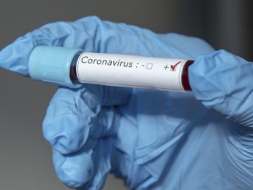 В Україні зафіксували 73 випадки захворювання на коронавірус
