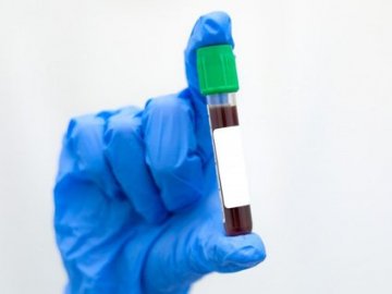 Оприлюднили статистику щодо коронавірусу в Україні за минулу добу