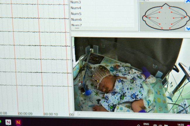 У Луцьку відкрили оновлений неонатальний центр для немовлят-«поспішайок». ФОТО