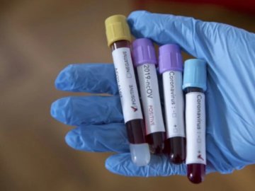 На Волині працівниця інфекційного відділення лікарні захворіла на COVID-19