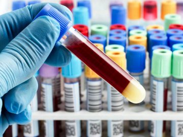 У Луцьку на коронавірус захворіли працівники фірми «Арго Р»