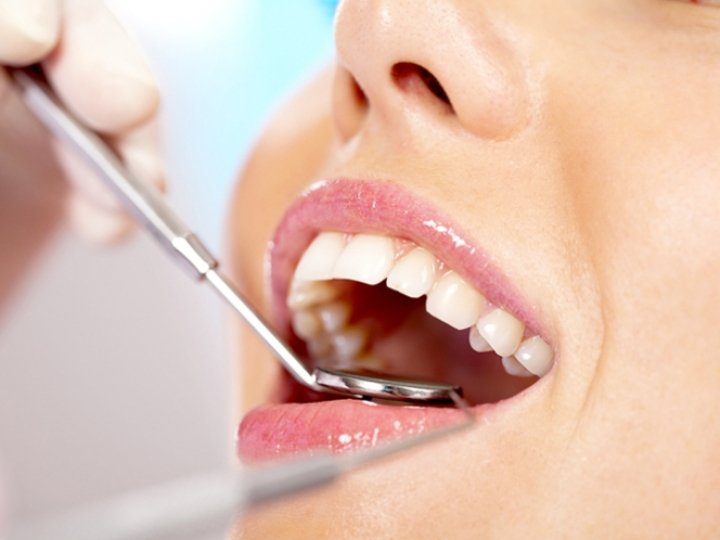 Імплантація щелепи Київ ціна — надійне рішення з прогнозованим результатом