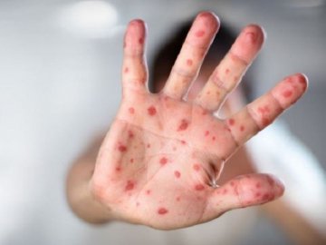 Кір атакував Волинь з новою силою