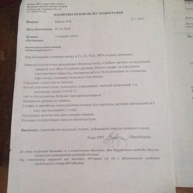 «Допоможіть врятувати дитину»: важкохворій волинянці необхідно зібрати 100 тисяч доларів на операцію. ФОТО